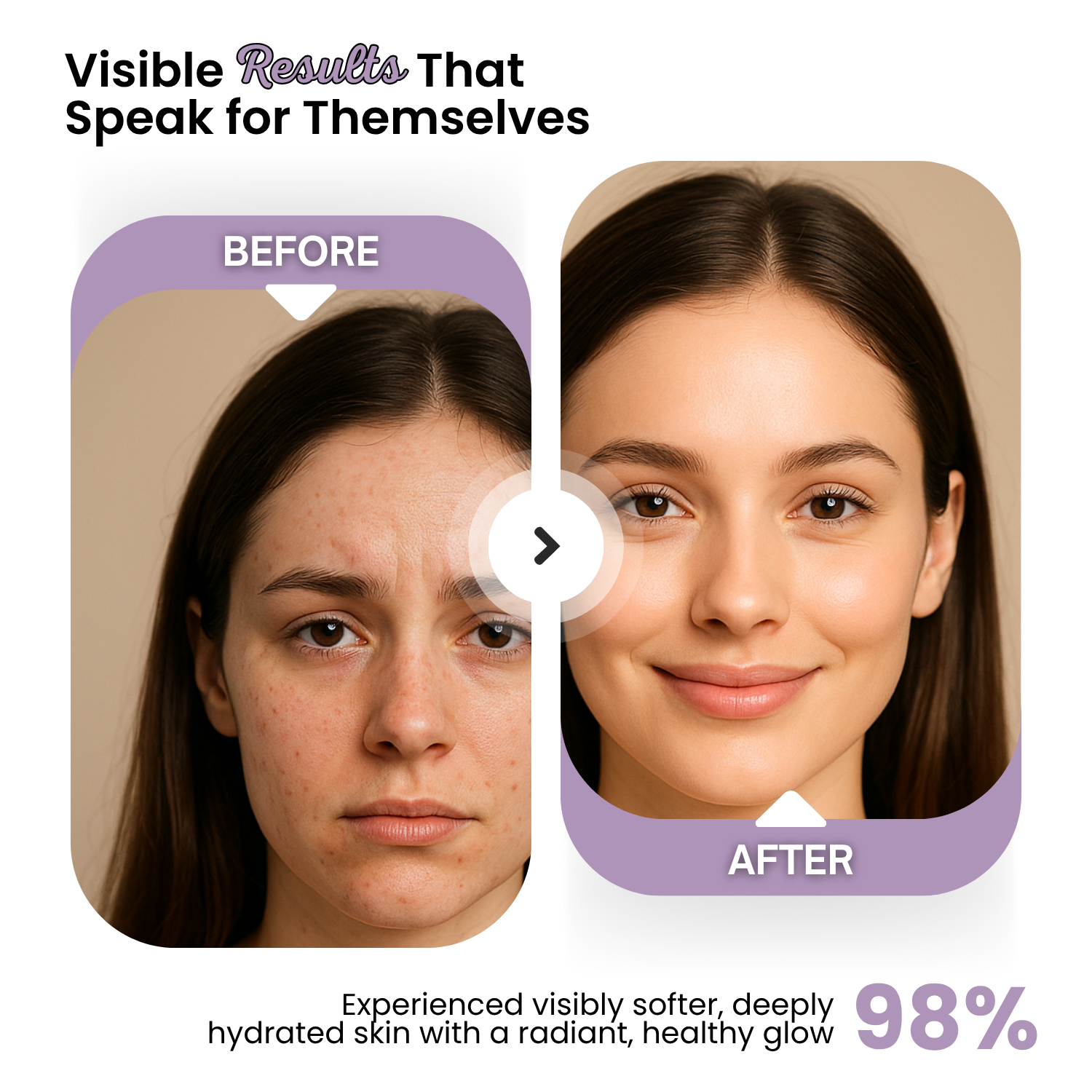 Advanced Double Repair Face Moisturizer: Deep Hydration and Skin Barrier Repair - Image 3