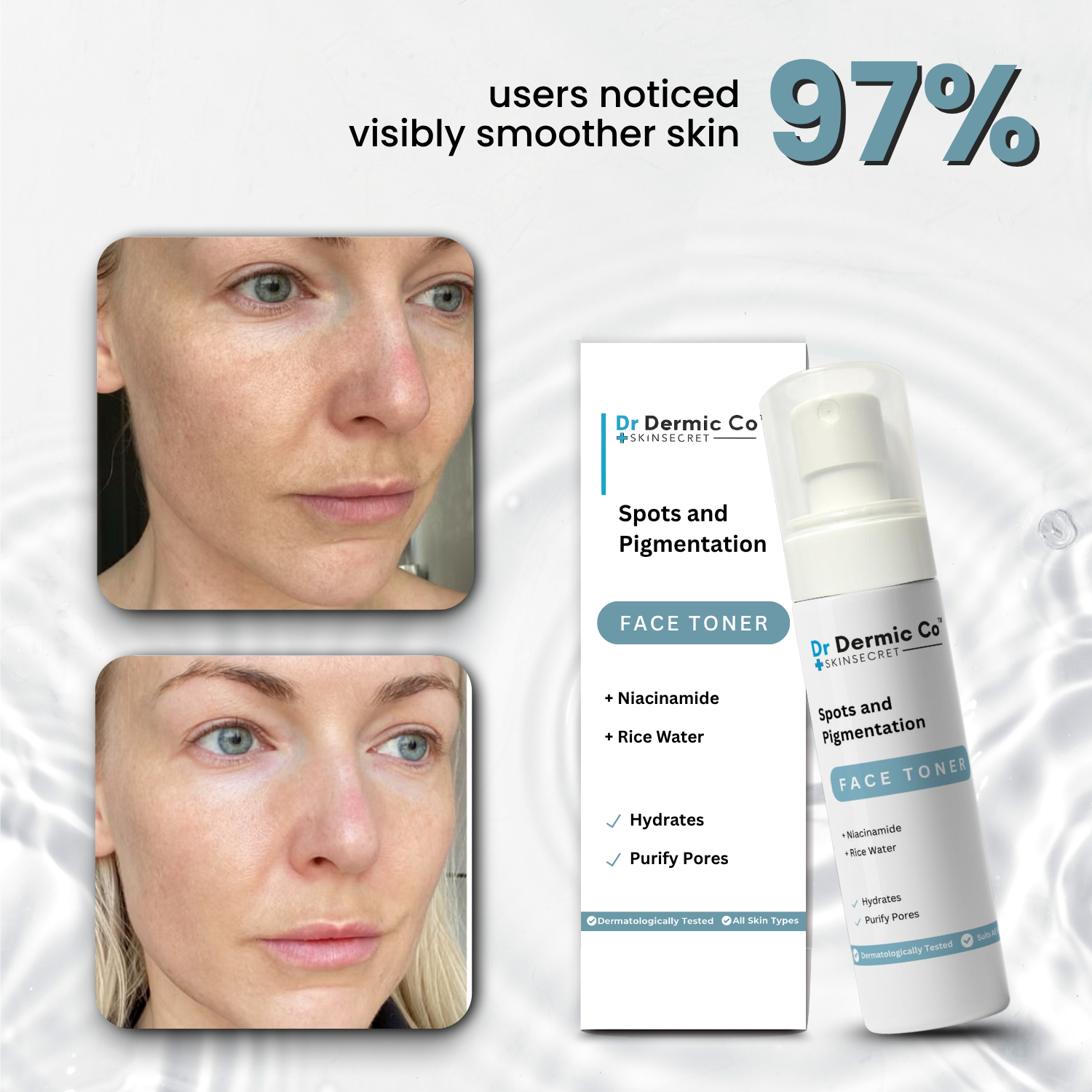 Spots & Pigmentation Face Toner: Brighten and Even Out Skin Tone - Image 3