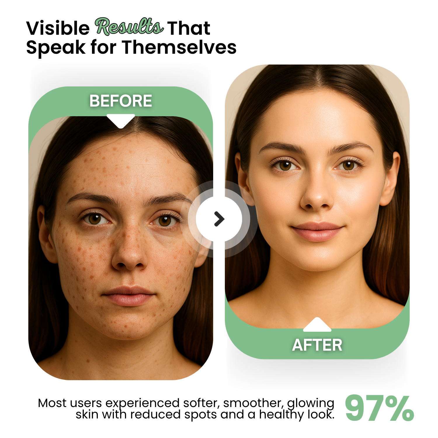 Spots & Flawless Skin Face Moisturizer: Brighten and Perfect Your Complexion - Image 3