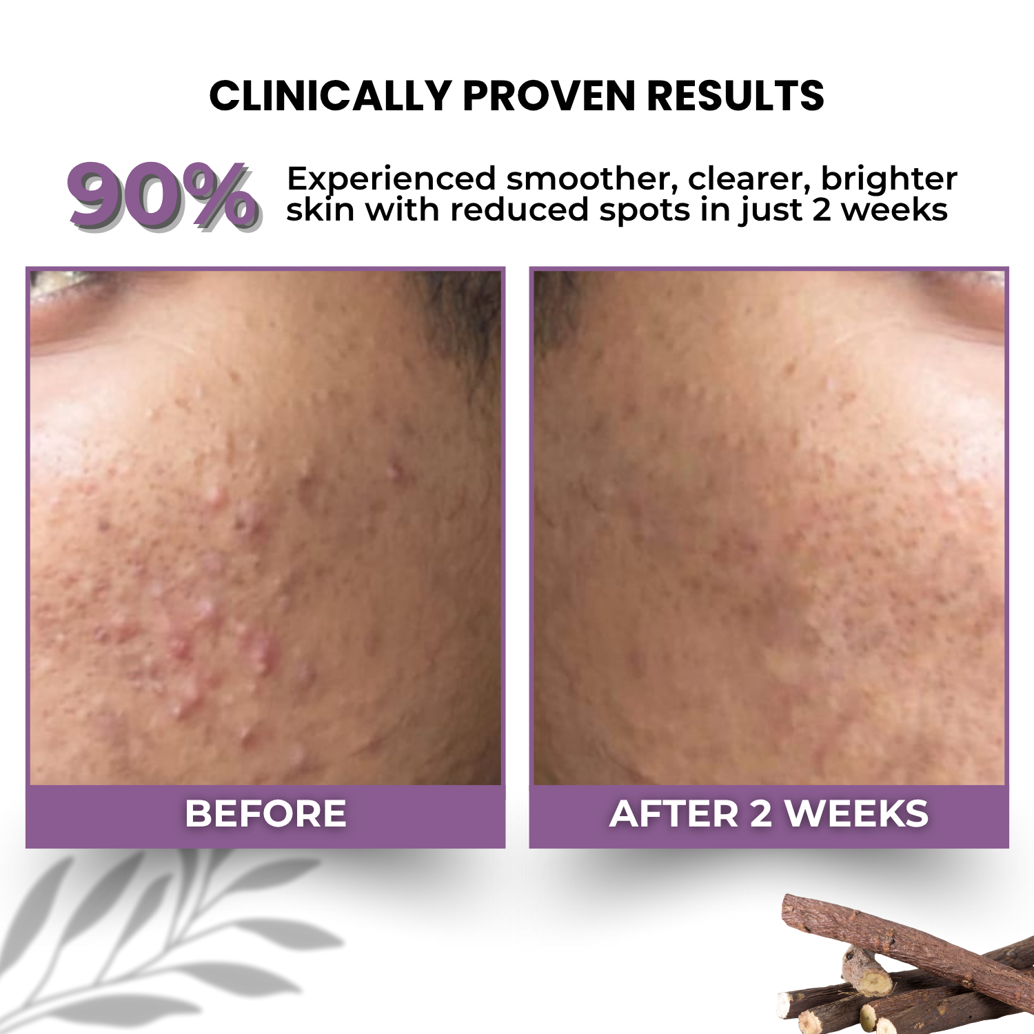 2% Kojic Acid Face Serum with Alpha Arbutin, Niacinamide & Licorice Extract - Image 3