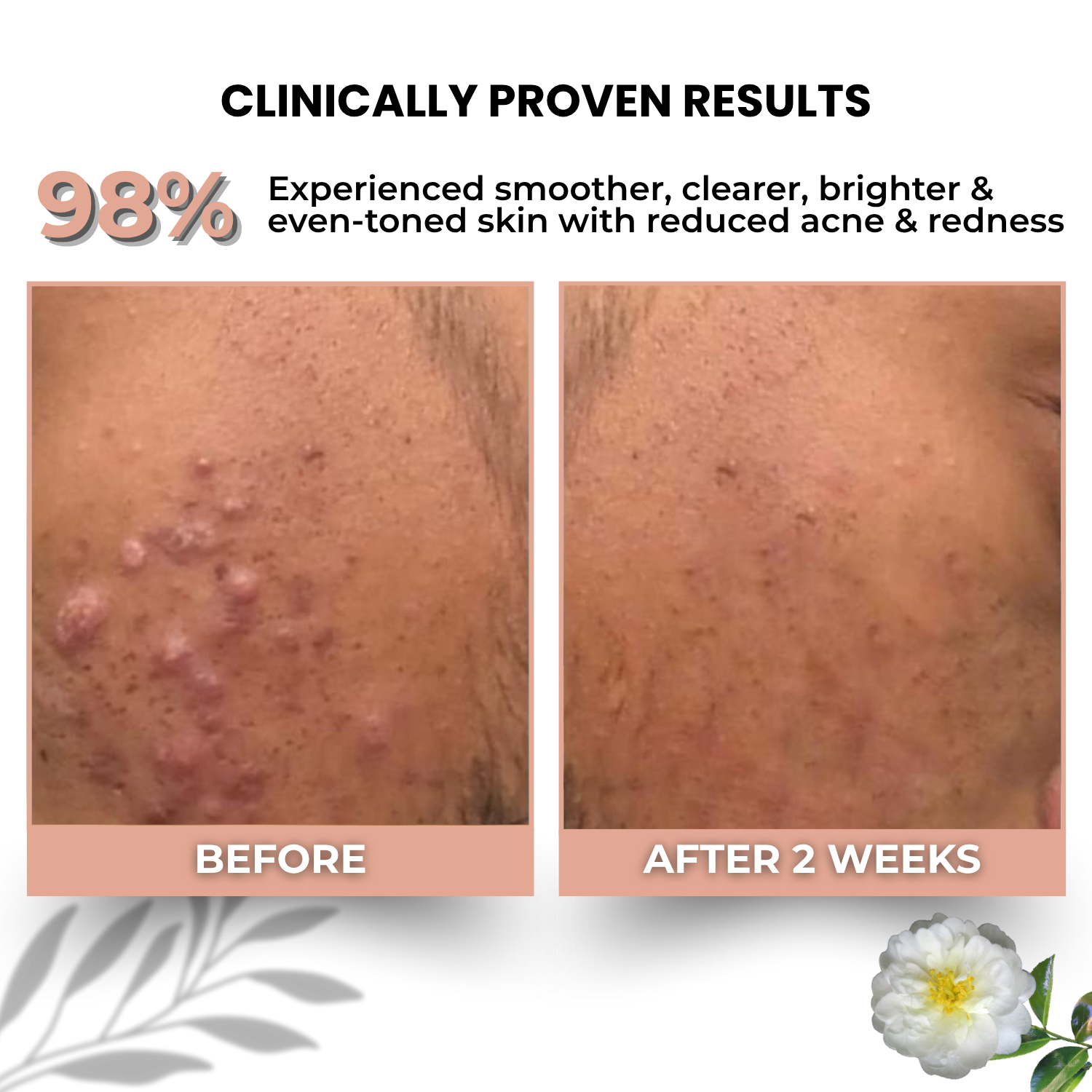 30% AHA + 2% BHA Face Serum with L-Glutathione, Salicylic Acid & Camellia Sinensis - Image 3