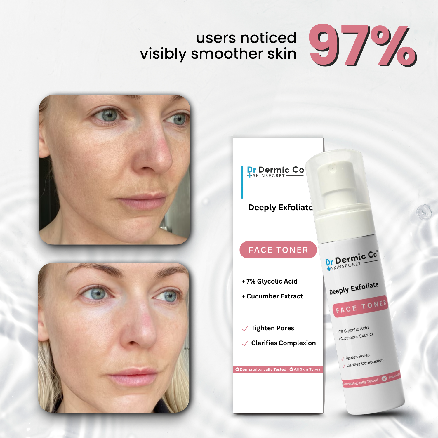 Deeply Exfoliates Face Toner: Refresh, Revitalize, and Renew Your Skin - Image 3