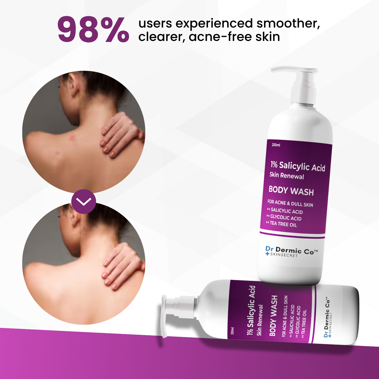 1% Salicylic Acid Body Wash for acne and dull skin. Key actives are salycylic acid, glycolic acid, tea tree oil - Image 3