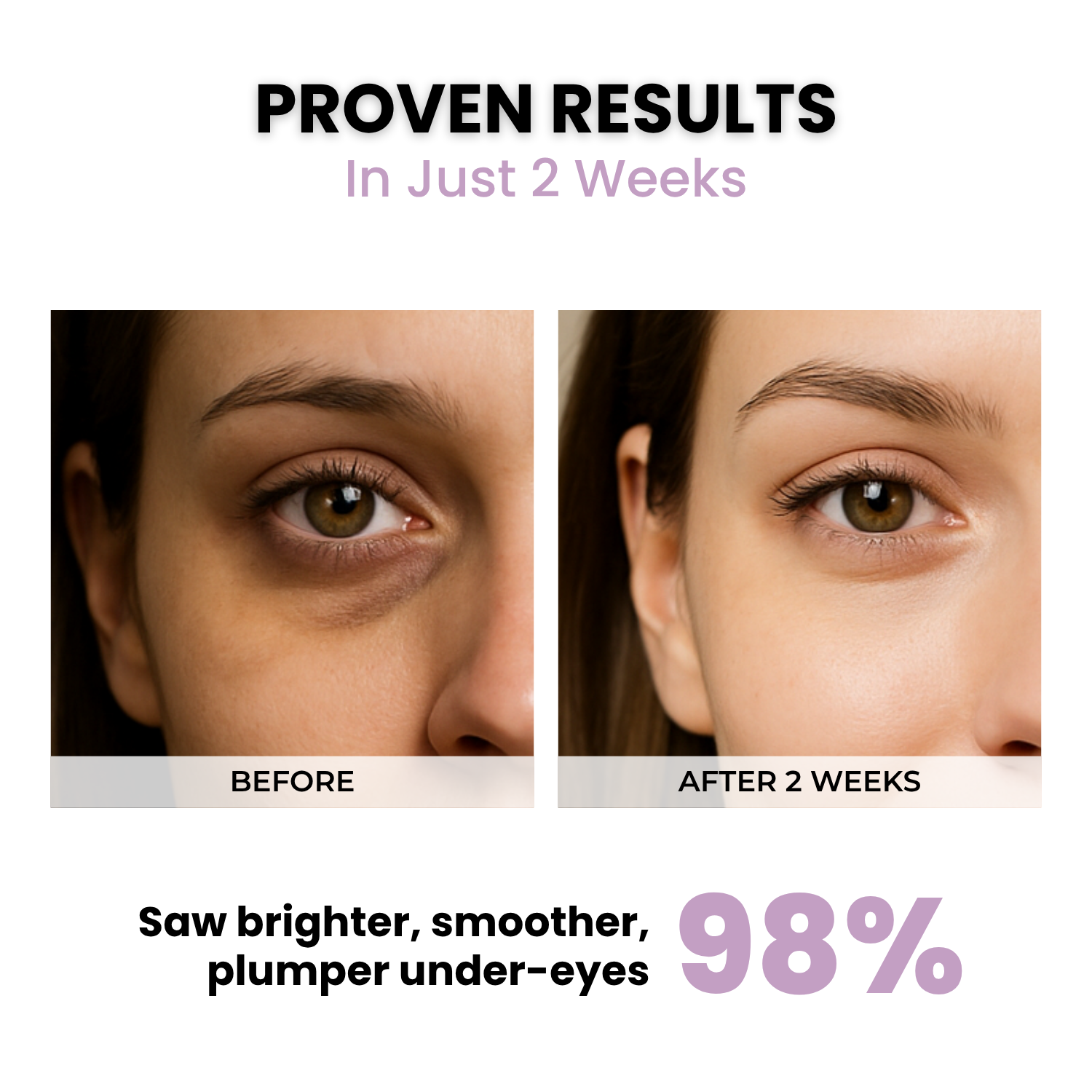 HydroGlow Under Eye Serum - Image 3