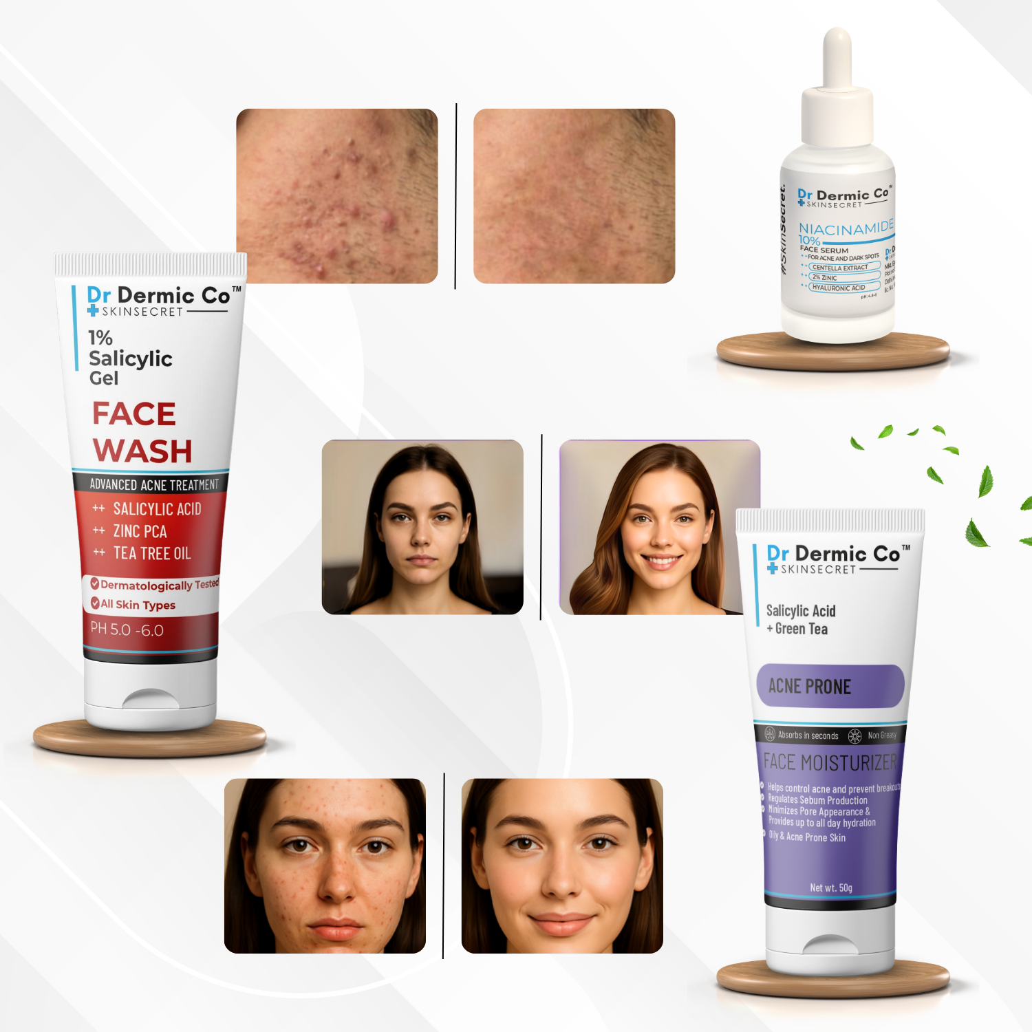 Acne kit (Salicylic Facewash + Niacinamide Serum + Acne Moisturiser) - Image 3