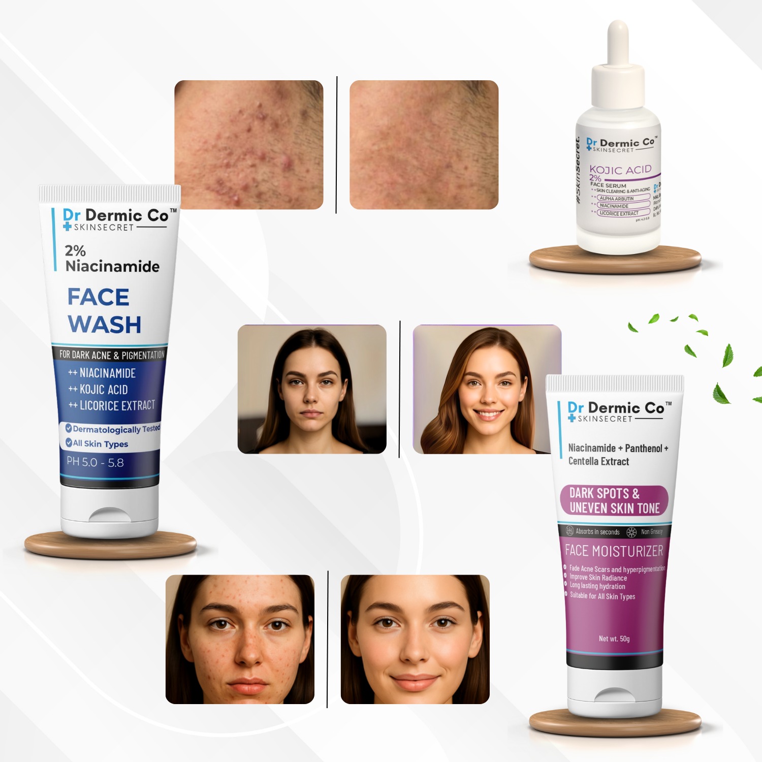 Full Pigmentation Kit (Niacinamide Facewash + Kojic Serum+ Dark Spots Moisturiser) - Image 3