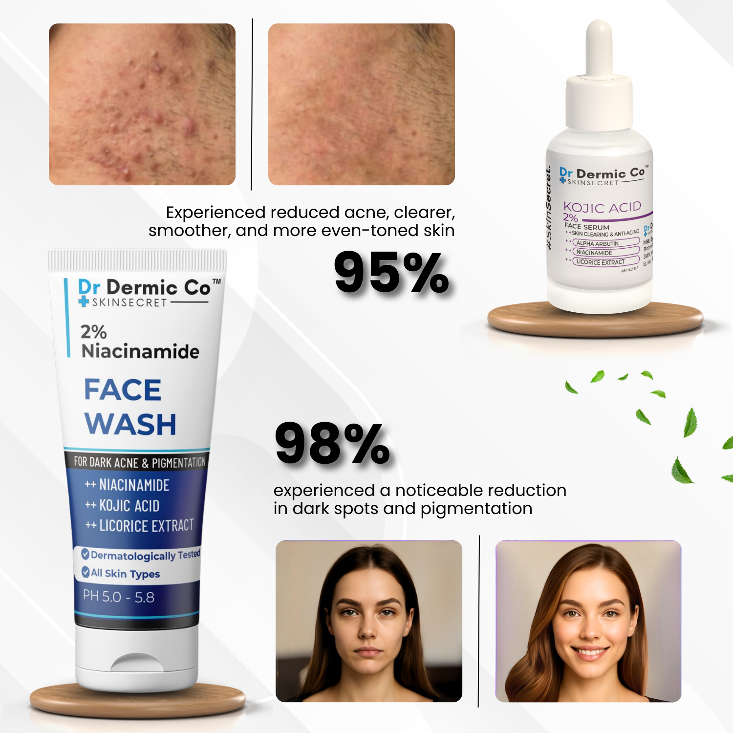 Dark spots and Pigmentation Combo (Niacinamide Facewash + Kojic Serum) - Image 2